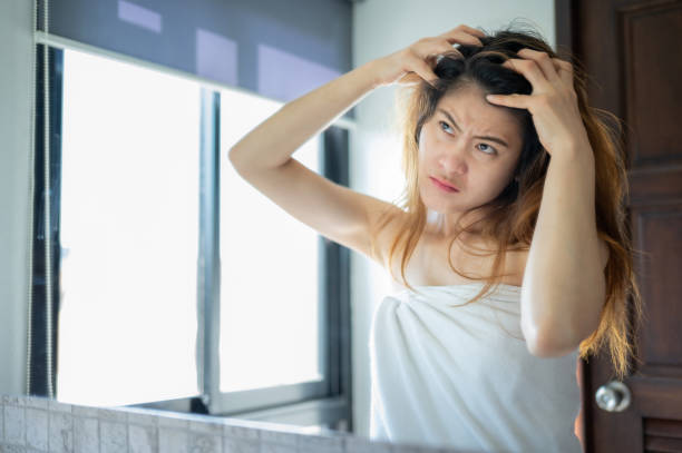 Homemade hair mask for dandruff and itchy scalp